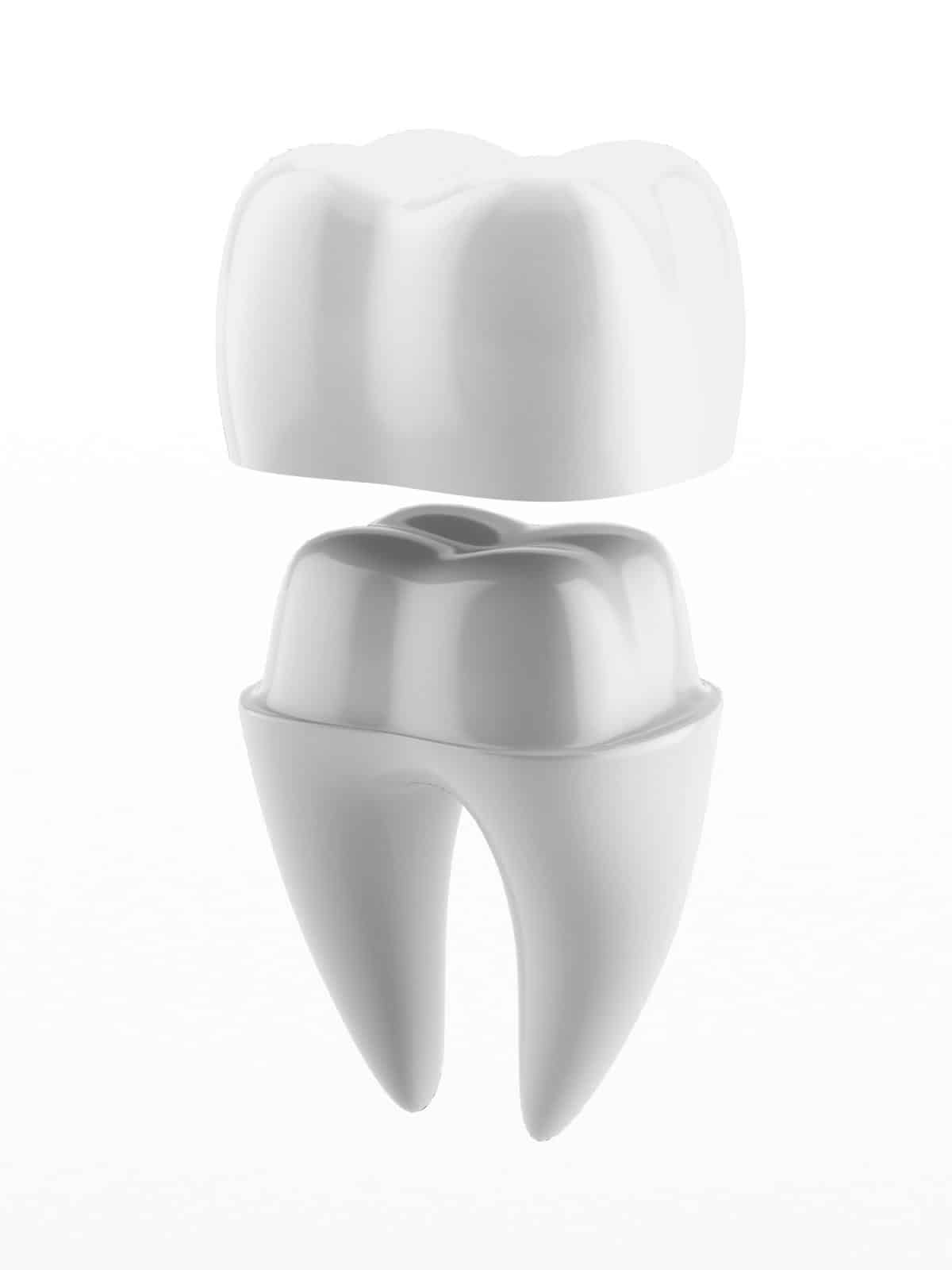 dental-crowns-fort-lauderdale-traditional-crowns-same-day-crowns